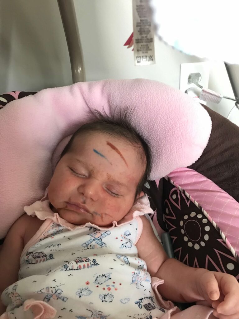 Infant in swing covered with marker lines.